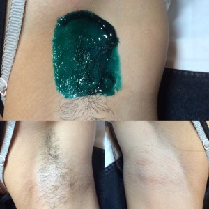 Under Arm Wax Before, During, After