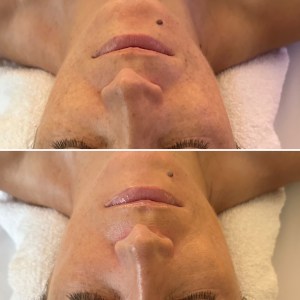 Custom Facial