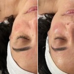 Custom Facial