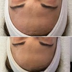 Custom Facial