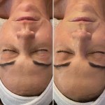 Custom Facial
