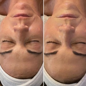 Custom Facial