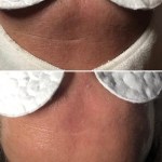Anti-Aging Facial