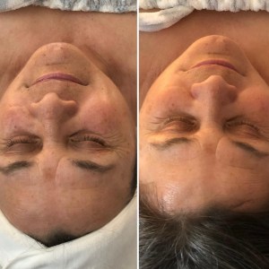 Custom Facial