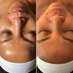 Custom Facial