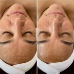 Custom Facial