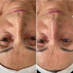 Custom Facial