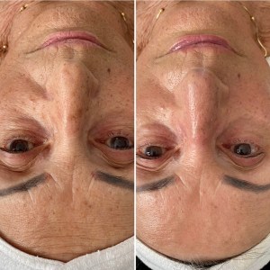 Custom Facial