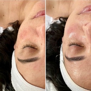 Custom Facial