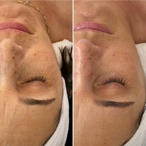 Custom Facial