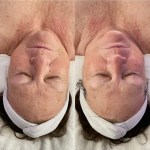 Custom Facial