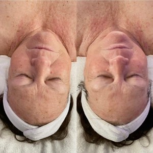Custom Facial