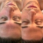 Custom Facial