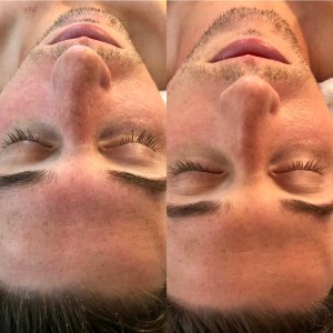Custom Facial
