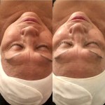 Custom Facial